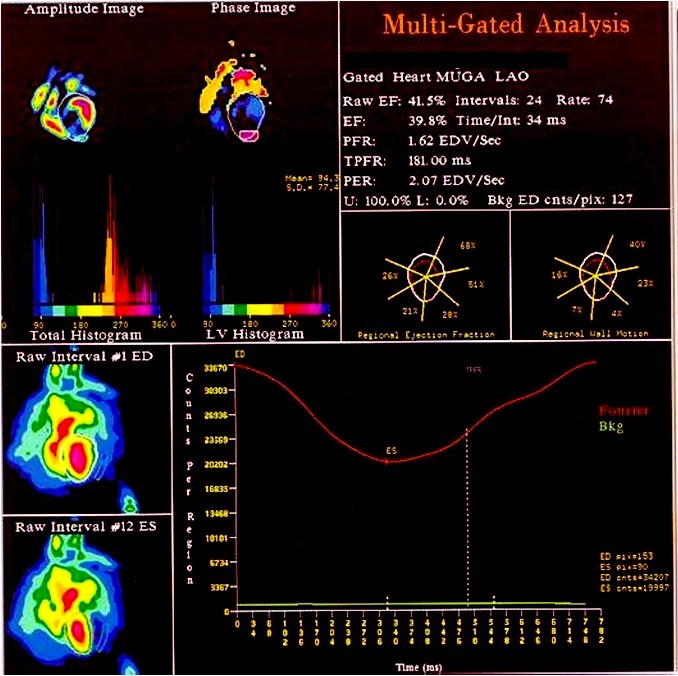 Interpret This MUGA Scan